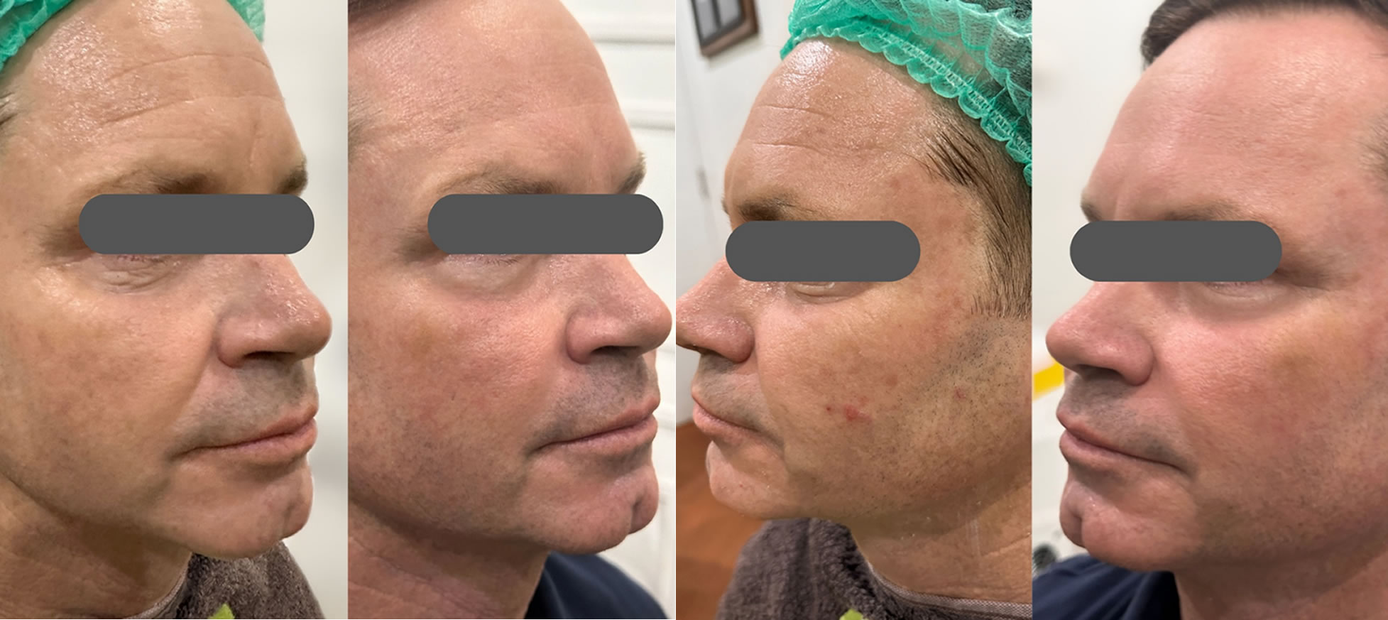 Meningkatkan Kesehatan Kulit secara Alami di Nindia Clinic